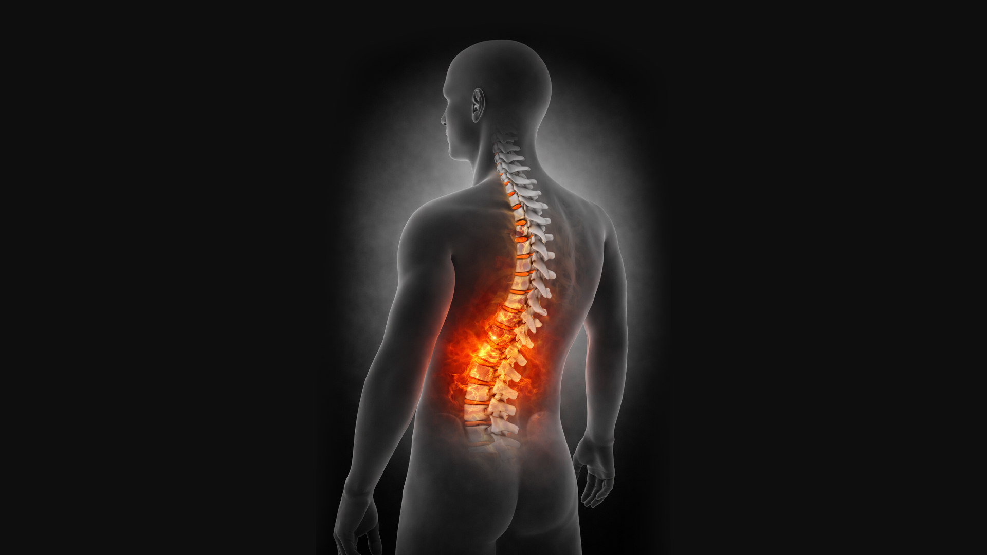 Ce este durerea lombară?